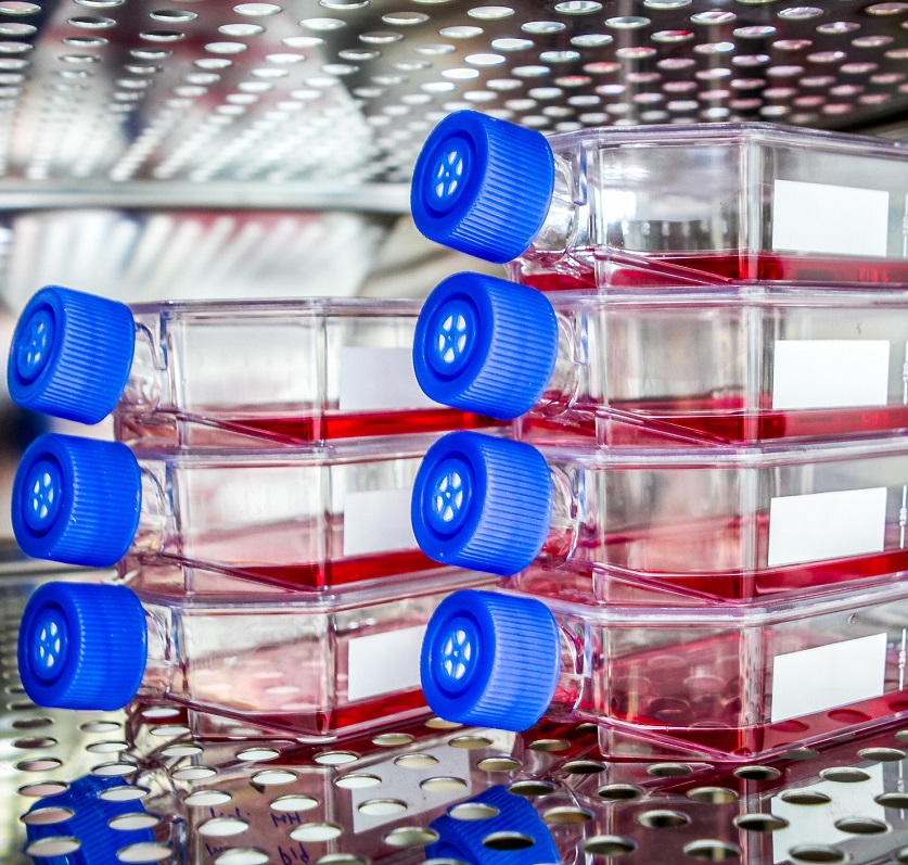 Monoclonal Antibodies Production